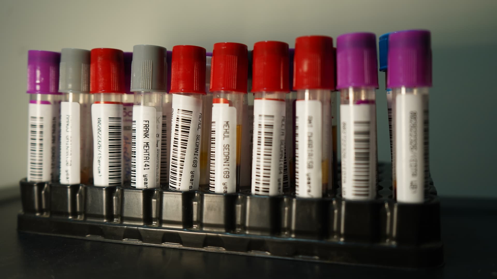 Labelled blood samples in the pathology lab